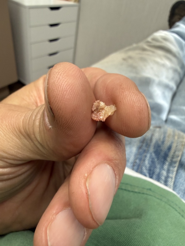 2025/12(December)/Misc/2025-12-11-removed-tooth-sleeve.JPG